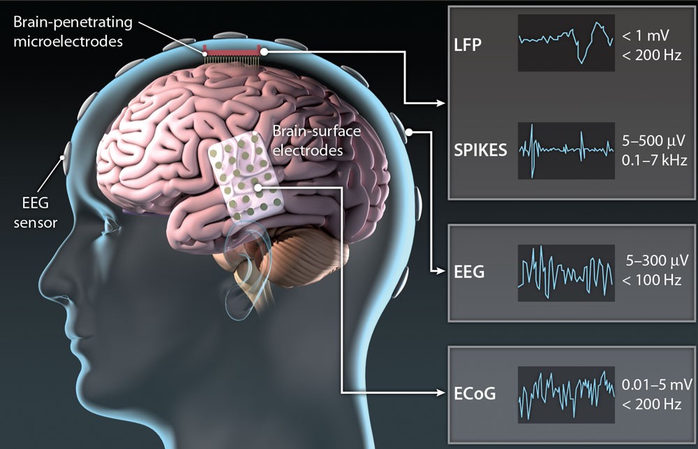 Neural Headphones: Bridging Mind and Machine 1 Neural Headphones: Bridging Mind and Machine
